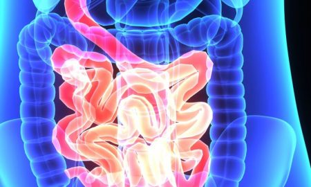 lifetime risk of colon cancer