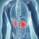 New hope for kidney cancer sufferers as scientists reveal a 'breakthrough' combination of drugs has the potential to clear tumours from patients
